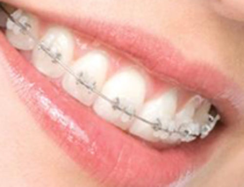 LA ORTODONCIA ES MUCHO MÁS QUE UN TRATAMIENTO ESTÉTICO