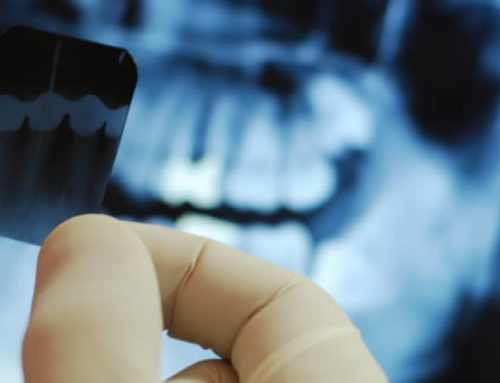 ¿SABES QUÉ ES LA RADIOLOGÍA DIGITAL?